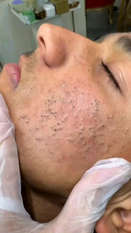 Máscara Facial