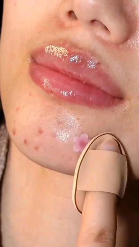 CORRETIVO VIRAL!🚨😱😳 Cobre todas as manchas😨 #corretivo #maquiagem #viral #acheinashopee  #acne #adesivo