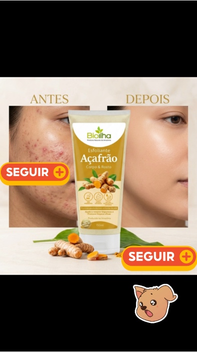 Esfoliante de Açafrão - Foliculite, Clareamento, Trata Acne, Espinhas 150ml #esfoliador #clareamento #tratamentoacne #tratamentofoliculite #esfolinate